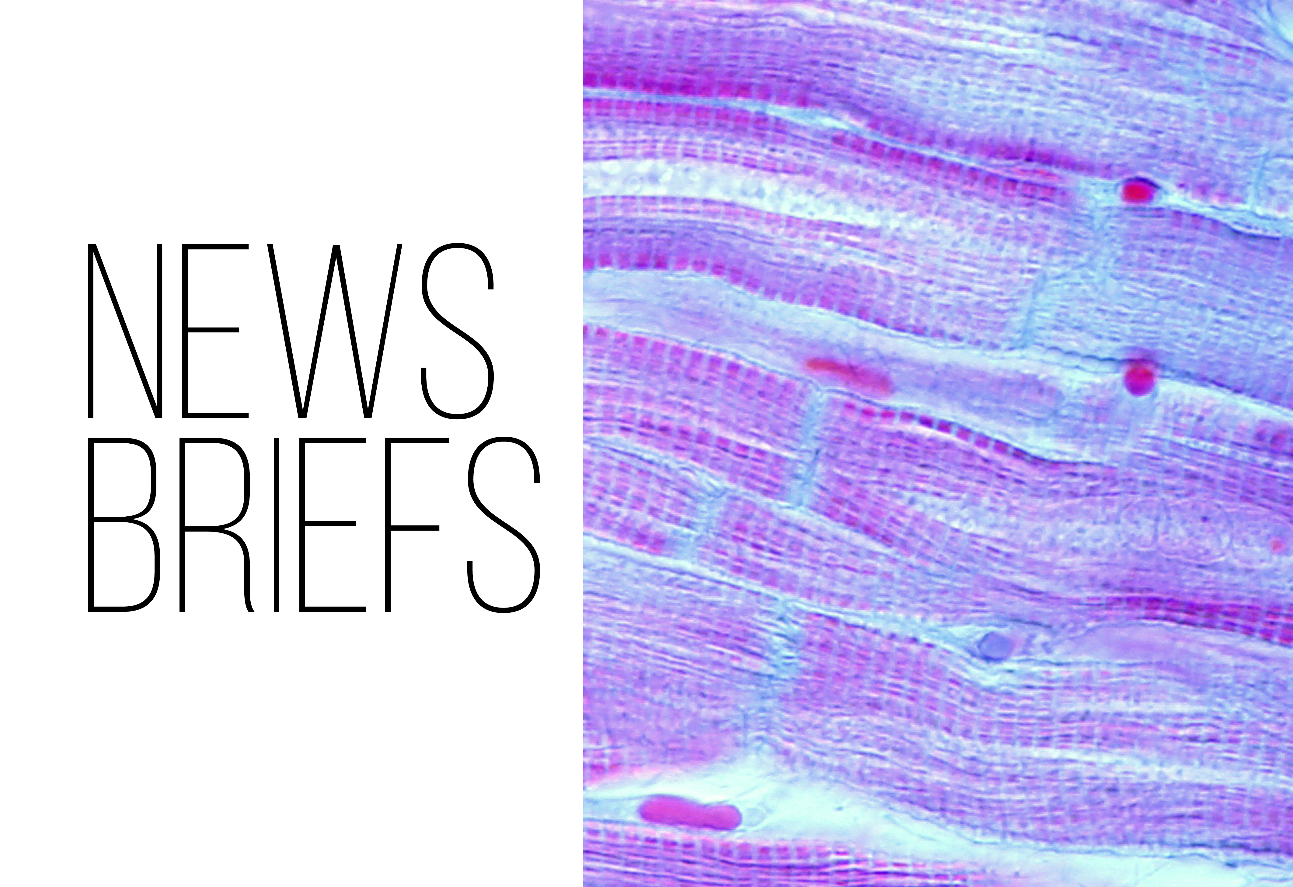 News Briefs text besides a slide of a cellular structure