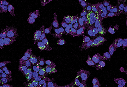 Peroxisomes are organelles that are critical to early development, aging, as well as severe metabolic disorders. Image provided by the Gardner Lab.